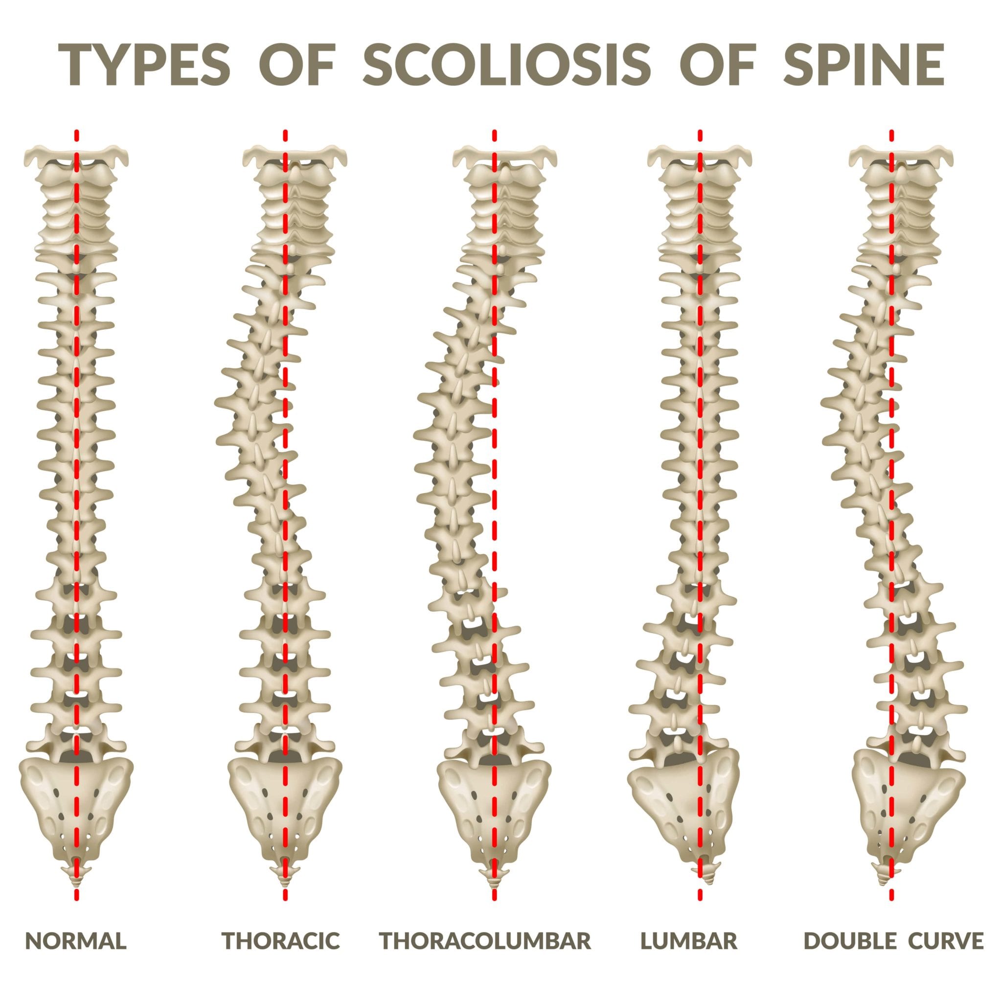 Chiropractic Care And Scoliosis Alternative Health Center Of The Woodlands 