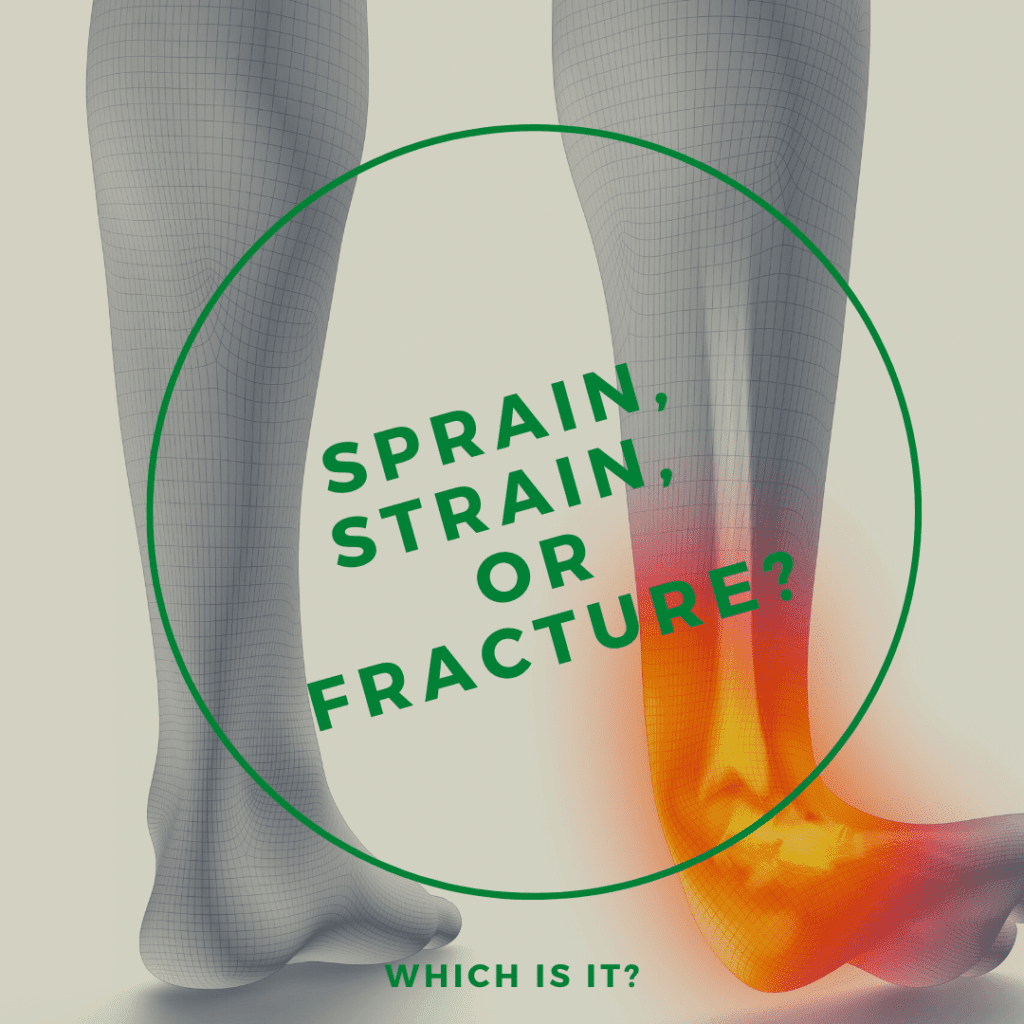 sprain-strain-or-fracture-which-is-it-alternative-health-center