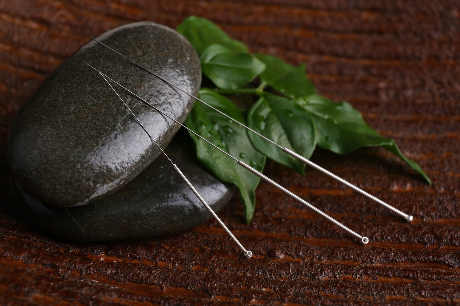 Does Acupuncture Hurt? | Alternative Health Center of The Woodlands