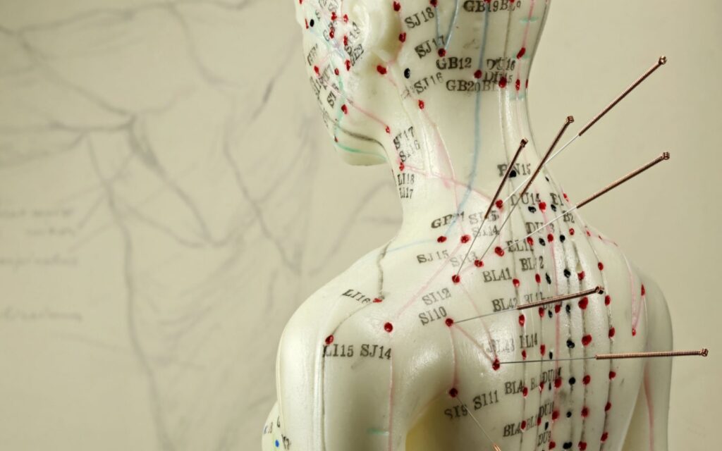 The History Of Acupuncture In Modern Medicine | Alternative Health ...